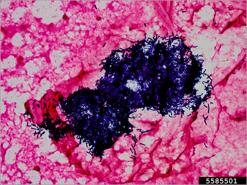Bacillus Thuringiensis